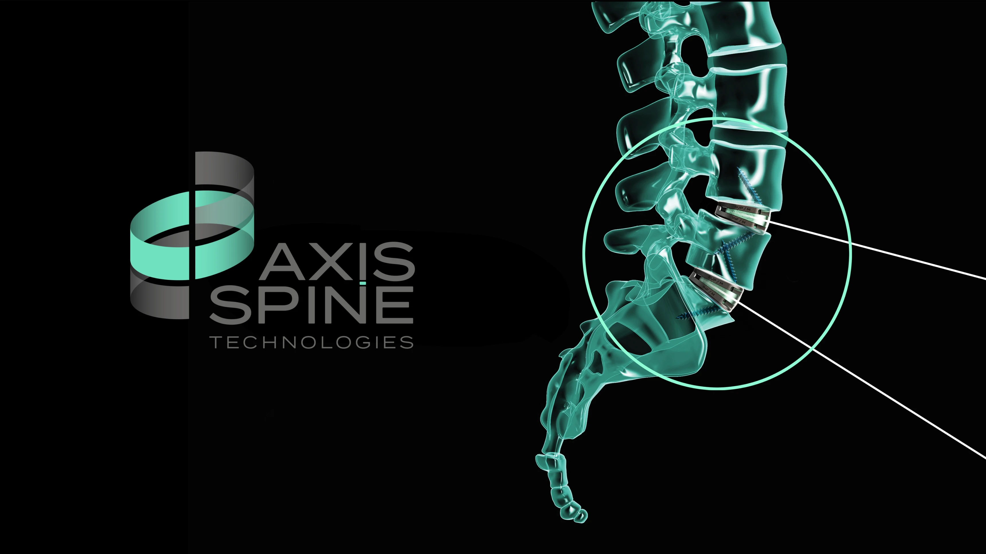 Axis Spine Brand Seymourpowell